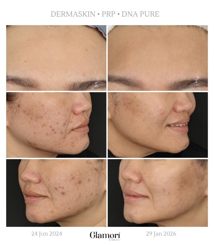 Derma Skin, PRP, DNA Pure