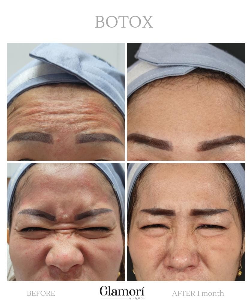 Face Contouring
